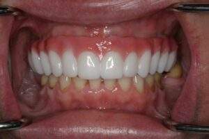 Miami Beach cosmetic dentist