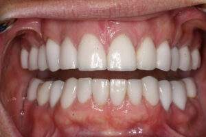 Miami Beach cosmetic dentist