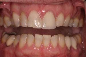 Miami Beach cosmetic dentist
