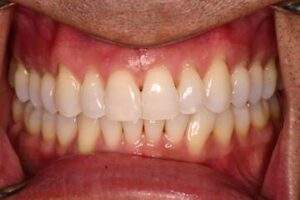Miami Beach cosmetic dentist
