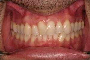 Miami Beach cosmetic dentist