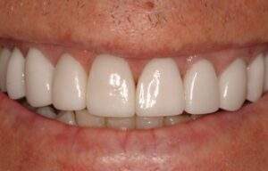 Miami Beach cosmetic dentist