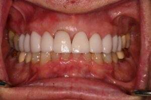 Miami Beach cosmetic dentist