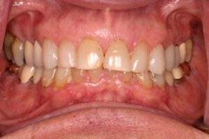 Miami Beach cosmetic dentist