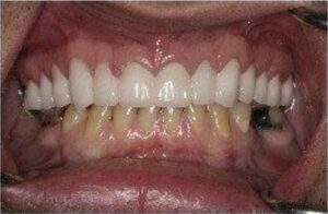 Miami Beach cosmetic dentist