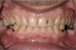 Miami Beach cosmetic dentist